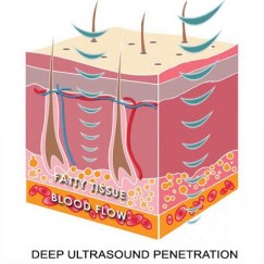 395-skin-layers-ultra